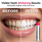 Advanced Stain-Removing Whitening Mouthwash